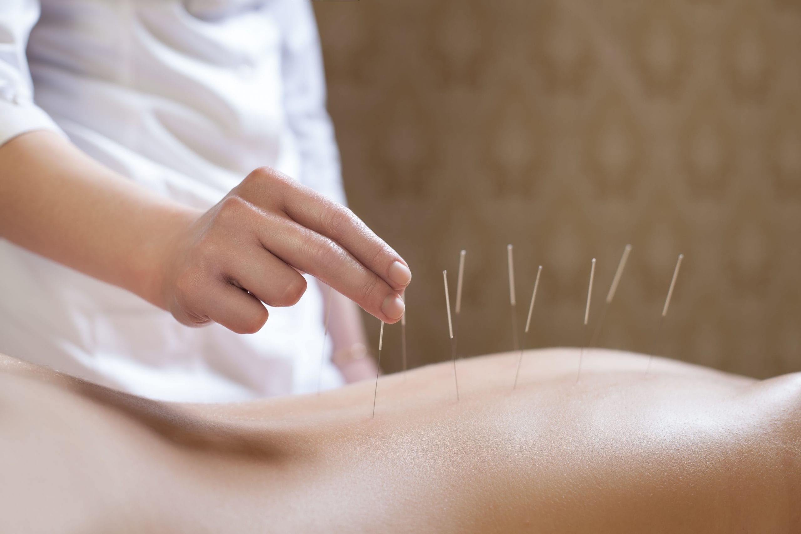 Opleiding TCM acupunctuur behandelaar