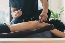 acupunctuur TCM opleidingen