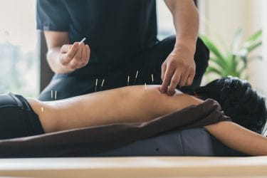acupunctuur TCM opleidingen