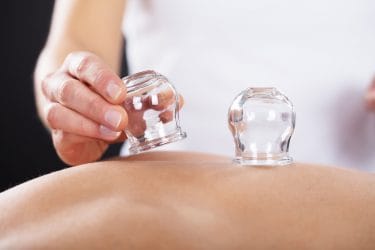 massagetherapeut maakt gebruik van vacuum cups als effectieve massagetools.