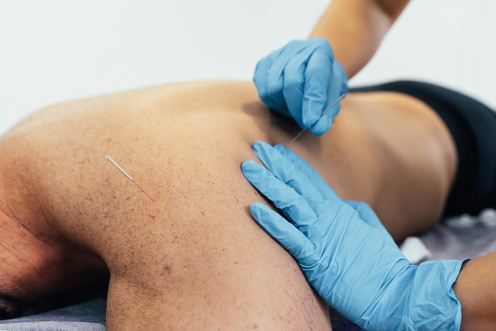 Waar wordt dry needling voor gebruikt?