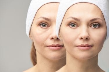 Tips voor de beste behandelingen voor wallen onder de ogen.