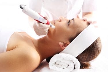 Je kunt littekens minder opvallend maken met microneedling.