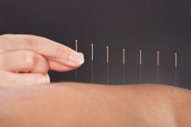 Doe je voordeel met een opleiding acupunctuur met STAP-budget