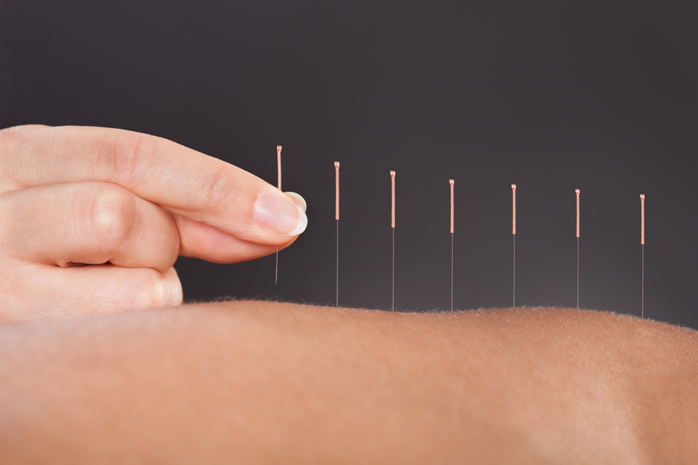 Tip: Opleiding acupunctuur met STAP-budget