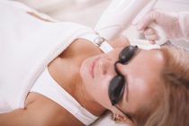 Tips voor behandelingen bij ouderdomsvlekken.