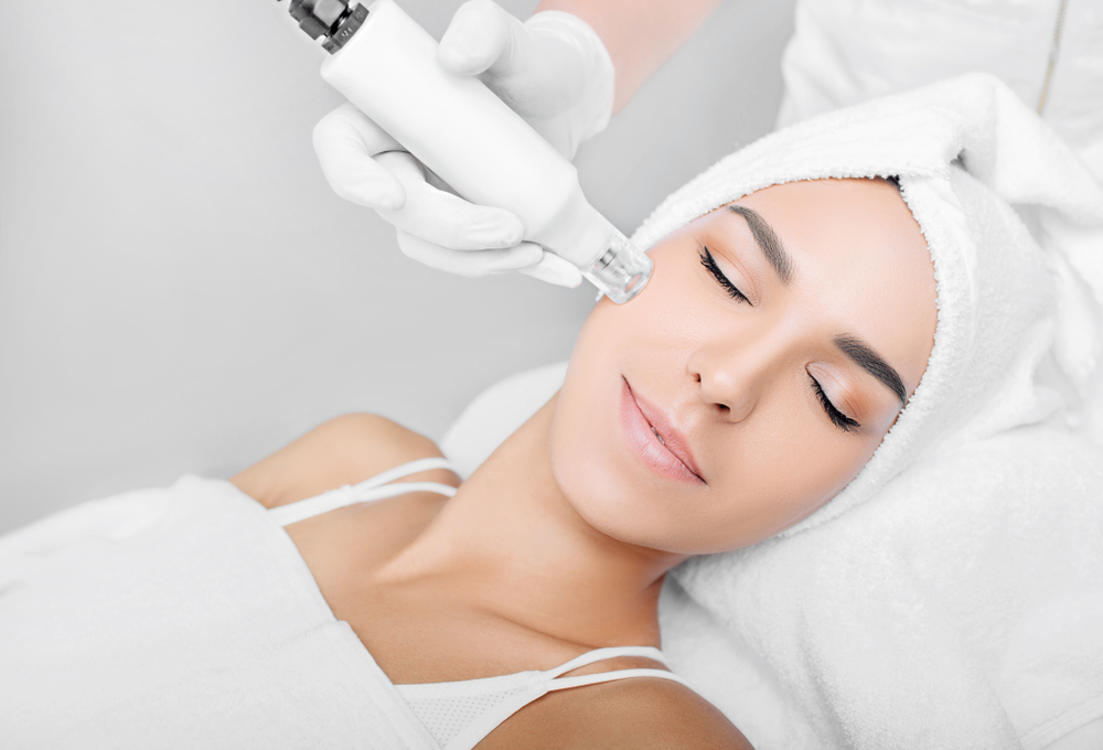 Microneedling: manueel of met een apparaatje?