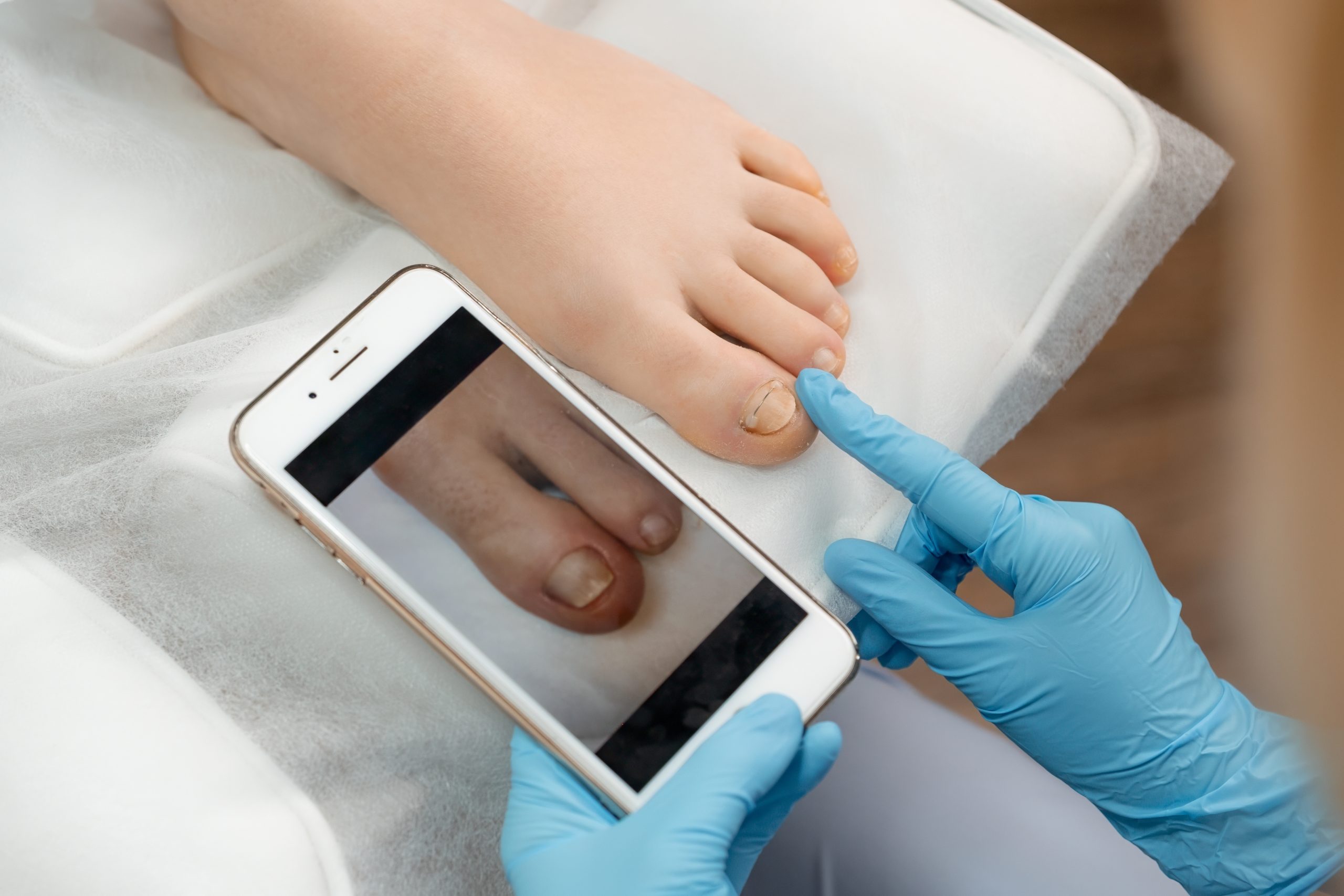 Pedicure voor en na: laat het verschil zien!